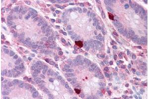 Human Small Intestine: Formalin-Fixed, Paraffin-Embedded (FFPE) (EEF2 抗体  (AA 36-85))