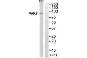Western blot analysis of extracts from rat brain cells, using PAK7 antibody. (PAK7 抗体  (C-Term))