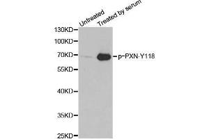Western blot analysis of extracts from 3T3 cells, using phospho-PXN-Y118 antibody. (Paxillin 抗体  (pTyr118))