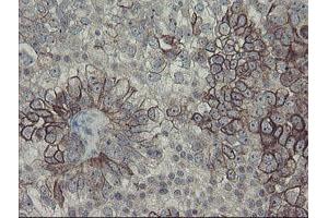 Image no. 9 for anti-Diphthamide Biosynthesis Protein 2 (DPH2) antibody (ABIN1497891)