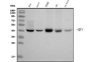 Western blot analysis of MPI using anti-MPI antibody (ABIN7600514).
