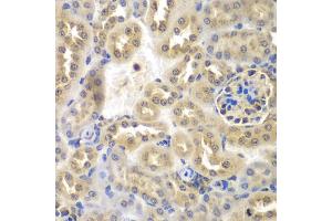 Immunohistochemistry of paraffin-embedded mouse kidney using SULT2B1 antibody (ABIN2737623) at dilution of 1:100 (40x lens). (SULT2B1 抗体)