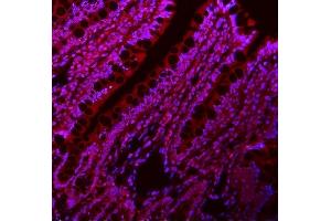 IF analysis of LIN28A using anti-LIN28A antibody (ABIN7601176).