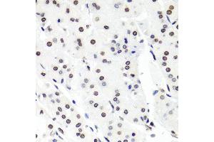 Immunohistochemistry of paraffin-embedded human stomach using HIST1H2BG antibody. (HIST1H2BG 抗体)
