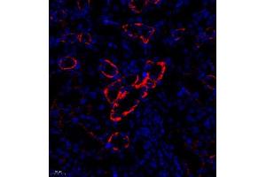 Immunofluorescence analysis of paraffin embedded rat nephritis using CD35 (ABIN7073563) at dilution of 1: 650 (CD35 抗体)