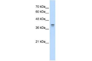Loricrin antibody used at 5 ug/ml to detect target protein. (LOR 抗体  (N-Term))