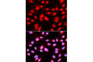 Immunofluorescence analysis of U2OS cells using U2AF2 antibody (ABIN5971000). (U2AF2 抗体)