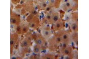 IHC-P analysis of Liver tissue, with DAB staining. (SAA 抗体  (AA 20-122))