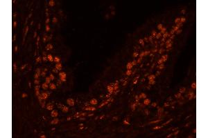 Immunofluorescence (IF) image for anti-Ubiquitin Specific Peptidase 47 (USP47) (C-Term) antibody (ABIN7449031) (USP47 抗体  (C-Term))