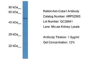 Western Blotting (WB) image for anti-Collagen and Calcium Binding EGF Domains 1 (CCBE1) (C-Term) antibody (ABIN2784990) (CCBE1 抗体  (C-Term))