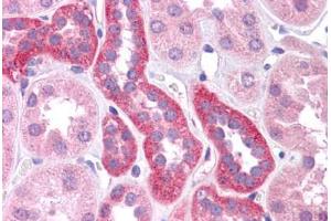Human Kidney: Formalin-Fixed, Paraffin-Embedded (FFPE) (HNF1A 抗体  (AA 179-228))