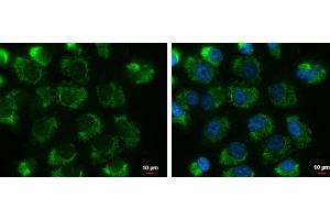 ICC/IF Image UQCRFS1 antibody [N1C3] detects UQCRFS1 protein at mitochondria by immunofluorescent analysis. (UQCRFS1 抗体)