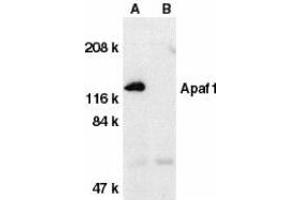 Western blot analysis of Apaf1 in human heart tissue lysate with Apaf1 (CT) antibody at 1μg/ml in the absence (A) or presence (B) of blocking peptide. (APAF1 抗体  (C-Term))