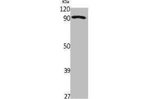 Western Blot analysis of Jurkat cells using ZNF227 Polyclonal Antibody (ZNF227 抗体  (Internal Region))