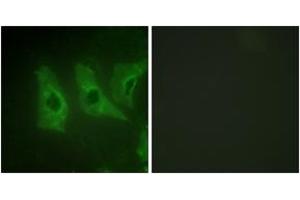Immunofluorescence analysis of HeLa cells, using CKI-alpha (Ab-321) Antibody. (CSNK1A1 抗体  (AA 287-336))