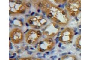 Used in DAB staining on fromalin fixed paraffin-embedded kidney tissue (CAPN1 抗体  (AA 185-356))