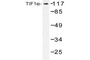 Western blot (WB) analysis of TIF1alpha antibody in extracts from COLO cells. (TRIM24 抗体)