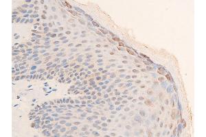 ABIN6267253 at 1/100 staining human skin tissue sections by IHC-P.