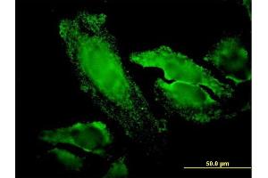 Immunofluorescence of monoclonal antibody to RPS7 on HeLa cell. (RPS7 抗体  (AA 95-194))