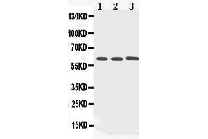 Western blot analysis of Cytokeratin 5 expression in rat kidney extract ( Lane 1), COLO320 whole cell lysates ( Lane 2) and HELA whole cell lysates ( Lane 3). (Cytokeratin 5 抗体  (Middle Region))