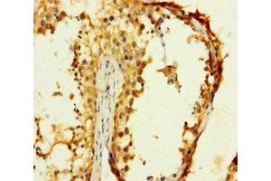 Immunohistochemistry of paraffin-embedded human testis tissue using ABIN7148974 at dilution of 1:100 (CST11 抗体  (AA 1-138))