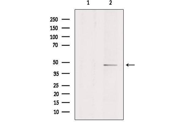 Endothelin-1 Receptor antibody  (C-Term)