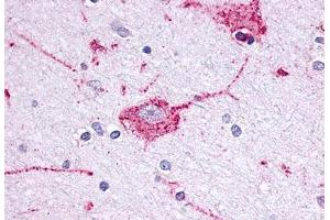 Anti-OPRM1 / Mu Opioid Receptor antibody  ABIN1049170 IHC staining of human brain, neuron. (Mu Opioid Receptor 1 抗体  (Extracellular Domain))