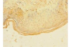 Immunohistochemistry of paraffin-embedded human skin tissue using ABIN7144737 at dilution of 1:100 (ASPHD1 抗体  (AA 96-390))