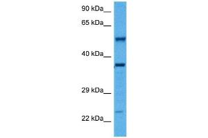 Host:  Rabbit  Target Name:  SMAD1  Sample Tissue:  Mouse Kidney  Antibody Dilution:  1ug/ml (SMAD1 抗体  (Middle Region))