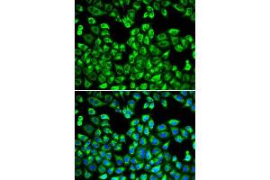 Immunofluorescence (IF) image for anti-Proteasome (Prosome, Macropain) 26S Subunit, ATPase, 2 (PSMC2) (AA 1-160) antibody (ABIN3015801)