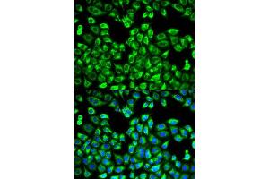 Immunofluorescence analysis of MCF-7 cell using PSMC2 antibody. (PSMC2 抗体  (AA 1-160))