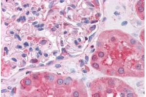 Human Kidney: Formalin-Fixed, Paraffin-Embedded (FFPE) (SHMT1 抗体  (AA 374-483))