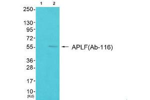 Western Blotting (WB) image for anti-Aprataxin and PNKP Like Factor (APLF) (Ser116) antibody (ABIN1848316)