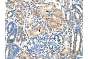 UBE2E2 antibody was used for immunohistochemistry at a concentration of 4-8 ug/ml to stain EpitheliaI cells of renal tubule (arrows) in Human Kidney. (UBE2E2 抗体)