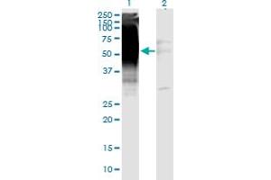 Western Blot analysis of GDF5 expression in transfected 293T cell line by GDF5 monoclonal antibody (M06), clone 1F4. (GDF5 抗体  (AA 28-127))