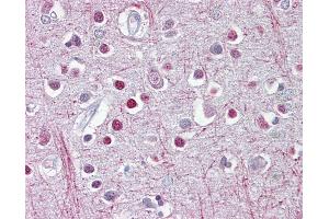 Anti-CNP antibody IHC of human brain, cortex. (Cnpase 抗体  (C-Term))