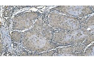 IHC analysis of Carbonic Anhydrase I/CA1 using anti-Carbonic Anhydrase I/CA1 antibody (ABIN7602621).