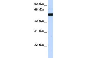 WB Suggested Anti-ZNF93 Antibody Titration:  0. (ZNF93 抗体  (N-Term))