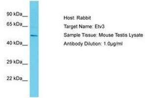 Image no. 1 for anti-Ets Variant 3 (ETV3) (AA 441-490) antibody (ABIN6750268) (ETV3 抗体  (AA 441-490))