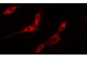 ABIN6274148 staining HeLa cells by IF/ICC. (TK1 抗体  (N-Term))