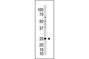 Image no. 1 for anti-Inducible T-Cell Co-Stimulator (ICOS) (C-Term) antibody (ABIN358624) (ICOS 抗体  (C-Term))