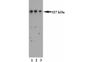 Western blot analysis of MSH3 on a HeLa cell lysate (Human cervical epitheloid carcinoma, ATCC CCL-2). (MSH3 抗体  (AA 136-349))