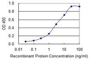 Detection limit for recombinant GST tagged DST is 0. (Dystonin 抗体  (AA 401-500))