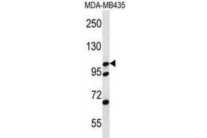 Western Blotting (WB) image for anti-Catenin (Cadherin-Associated Protein), delta 2 (Neural Plakophilin-Related Arm-Repeat Protein (CTNND2) antibody (ABIN2996812) (CTNND2 抗体)