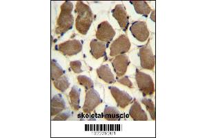 LRP3 Antibody immunohistochemistry analysis in formalin fixed and paraffin embedded human skeletal muscle followed by peroxidase conjugation of the secondary antibody and DAB staining. (LRP3 抗体  (C-Term))