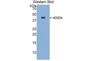 Western Blotting (WB) image for anti-Transferrin Receptor 2 (TFR2) (AA 4-87) antibody (ABIN1172689) (Transferrin Receptor 2 抗体  (AA 4-87))