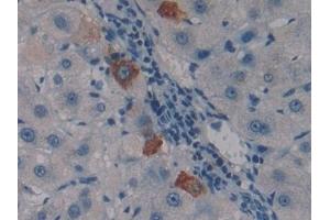 Detection of PSG1 in Human Liver Tissue using Polyclonal Antibody to Pregnancy Specific Beta-1-Glycoprotein 1 (PSG1) (PSG1 抗体  (AA 202-401))