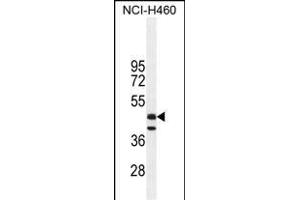 Western Blotting (WB) image for anti-Fibrinogen-Like 2 (FGL2) (AA 338-367), (C-Term) antibody (ABIN655073)