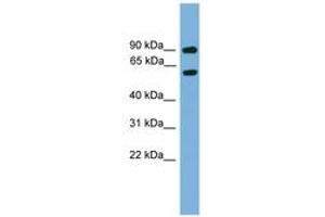 Image no. 1 for anti-NGFI-A Binding Protein 2 (EGR1 Binding Protein 2) (NAB2) (AA 401-450) antibody (ABIN6744541) (NAB2 抗体  (AA 401-450))