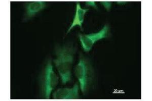 Immunostaining analysis in HeLa cells. (HARS1/Jo-1 抗体)